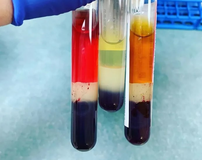 Serum Separated From Blood By A Gel Layer.